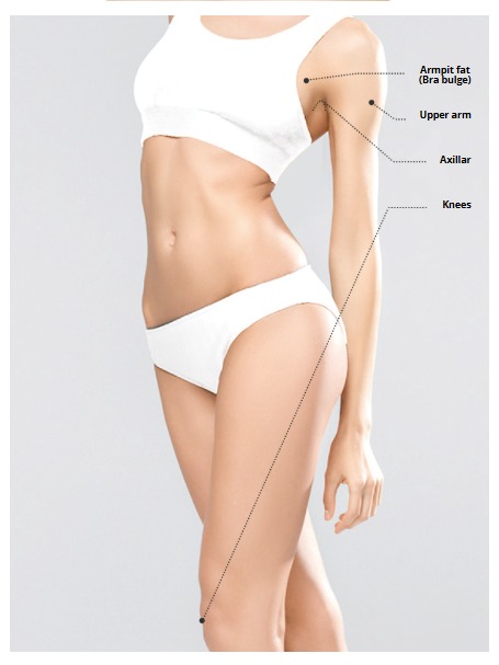 HIFU Treatment Areas in Lucknow